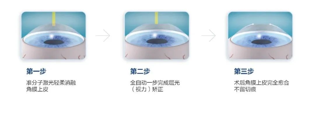 2025年海軍招飛新變化！鄭州愛爾眼科醫(yī)院游昌濤：做完近視手術(shù)也能參加選拔(圖3)