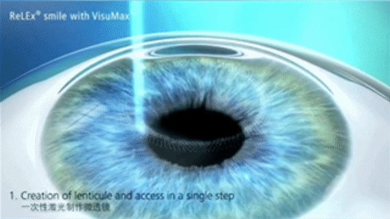 2025年海軍招飛新變化！鄭州愛爾眼科醫(yī)院游昌濤：做完近視手術(shù)也能參加選拔(圖4)