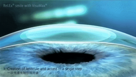 2025年海軍招飛新變化！鄭州愛爾眼科醫(yī)院游昌濤：做完近視手術(shù)也能參加選拔(圖5)